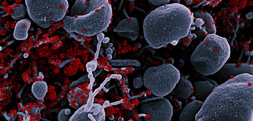 Colorized scanning electron micrograph of an apoptotic cell (gray) heavily infected with SARS-CoV-2 virus particles (red), isolated from a patient sample. Image captured at the NIAID Integrated Research Facility (IRF) in Fort Detrick, Maryland. Credit: NIAID - ALLOW IMAGES