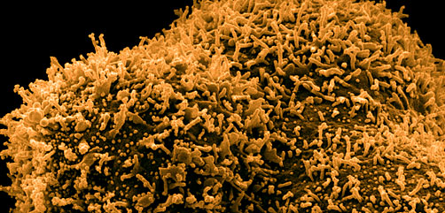 A cluster of CCL-81 cells infected with SARS-CoV-2 virus particles, which are the small spherical structures found on the surface of the cells. The protrusions extending from the cells are cell projections or pseudopodium. Image captured at the NIAID Integrated Research Facility (IRF) in Fort Detrick, Maryland. Credit: NIAID A cluster of CCL-81 cells infected with SARS-CoV-2 virus particles, which are the small spherical structures found on the surface of the cells. The protrusions extending from the cells are cell projections or pseudopodium. Image captured at the NIAID Integrated Research Facility (IRF) in Fort Detrick, Maryland. Credit: NIAID - ALLOW IMAGES