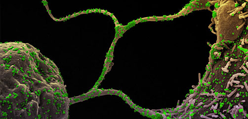 Colorized scanning electron micrograph of CCL-81 Cells infected with SARS-CoV-2 virus particles (green), isolated from a patient sample. The tentacle-like protrusions from the cells are filapodia, which extend from infected cells, attach to neighboring cells, and promote viral infection as a transport system for virus particles. Image captured at the NIAID Integrated Research Facility (IRF) in Fort Detrick, Maryland. Credit: NIAID - ALLOW IMAGES