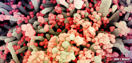 Colorized scanning electron micrograph of a cell heavily infected with SARS-CoV-2 virus particles (orange/red), isolated from a patient sample. Image captured at the NIAID Integrated Research Facility (IRF) in Fort Detrick, Maryland. Credit: NIAID - ALLOW IMAGES
