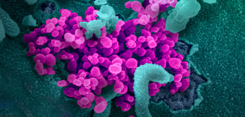 This scanning electron microscope image shows SARS-CoV-2 (round magenta objects) emerging from the surface of cells cultured in the lab. SARS-CoV-2, also known as 2019-nCoV, is the virus that causes COVID-19. - ALLOW IMAGES