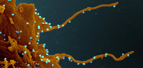 SARS-CoV-2 viruses visible on a cell with filopodia. Image credit: Elizabeth Fischer, Miscroscopy Unit NIH / NIAID. - ALLOW IMAGES